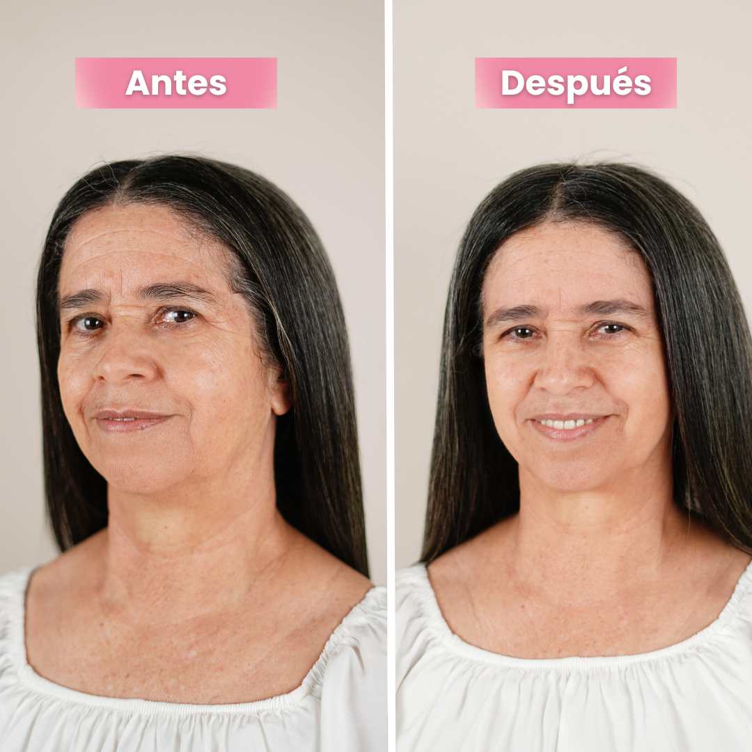 Dispositivo de Lifting Facial con Microcorriente QkShine®️